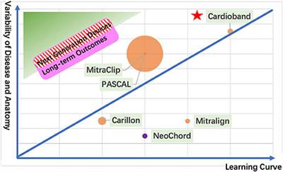 What Is the Next Generation of Transcatheter Mitral Valve Repair Devices?